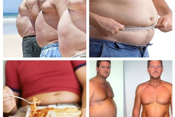 Удаление жира у мужчин. Жирный живот у мужчин свисающий. Похудение жир.